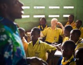  Boy with albinism